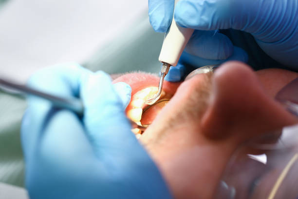 Best Orthodontic Emergency Dentist in Belvedere, CA